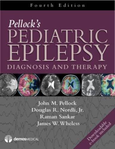 Pediatric Epilepsy: Diagnosis and Therapy