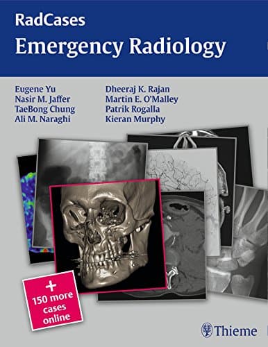 Emergency Radiology (Radcases)