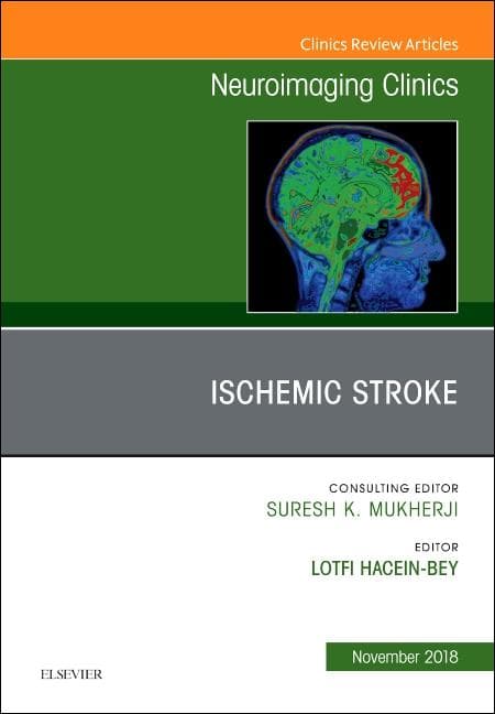 Ischemic Stroke, an Issue of Neuroimaging Clinics of North America: Volume 28-4