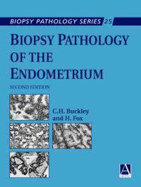 Biopsy Pathology of the Endometrium, 2ed