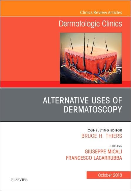 Alternative Uses of Dermatoscopy, an Issue of Dermatologic Clinics: Volume 36-4