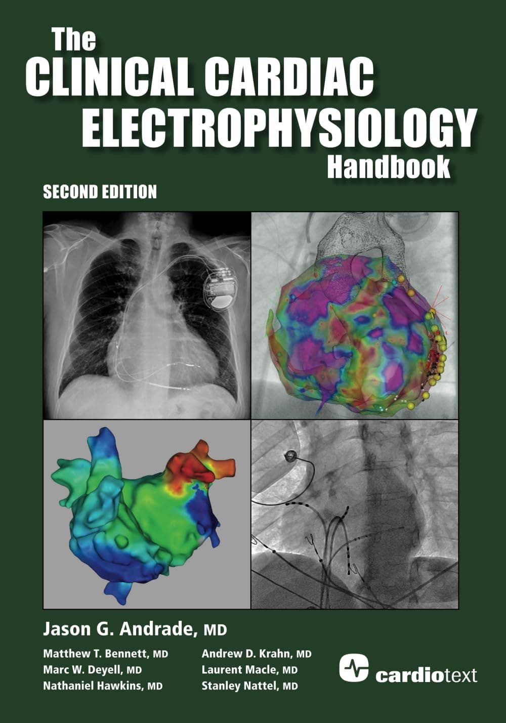 The Clinical Cardiac Electrophysiology Handbook, Second Edition