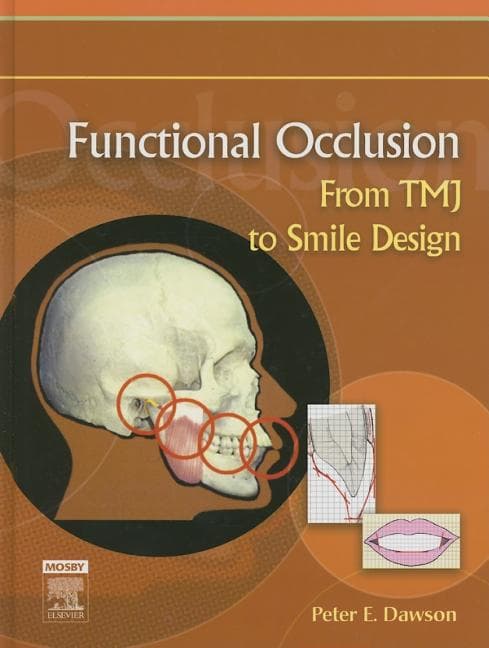 Functional Occlusion: From Tmj to Smile Design