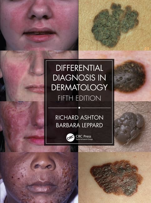 Differential Diagnosis in Dermatology