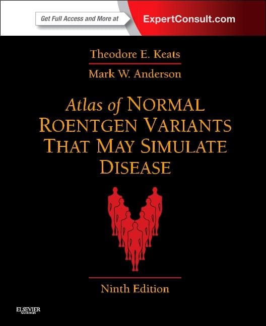 Atlas of Normal Roentgen Variants That May Simulate Disease: Expert Consult - Enhanced Online Features and Print (Revised)