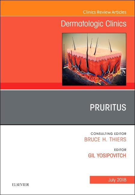 Pruritus, an Issue of Dermatologic Clinics: Volume 36-3
