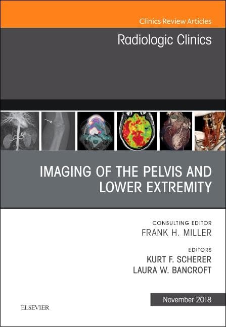 Imaging of the Pelvis and Lower Extremity, an Issue of Radiologic Clinics of North America: Volume 56-6