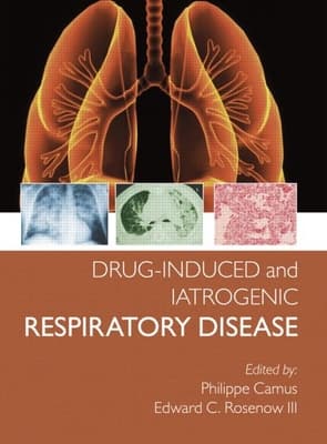 Drug-Induced and Iatrogenic Respiratory Disease