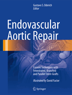Endovascular Aortic Repair: Current Techniques with Fenestrated, Branched and Parallel Stent-Grafts (2017)