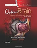 Osborn's Brain