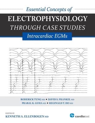 Essential Concepts of Electrophysiology Through Case Studies: Intracardiac EGMs: Intracardiac EGMs