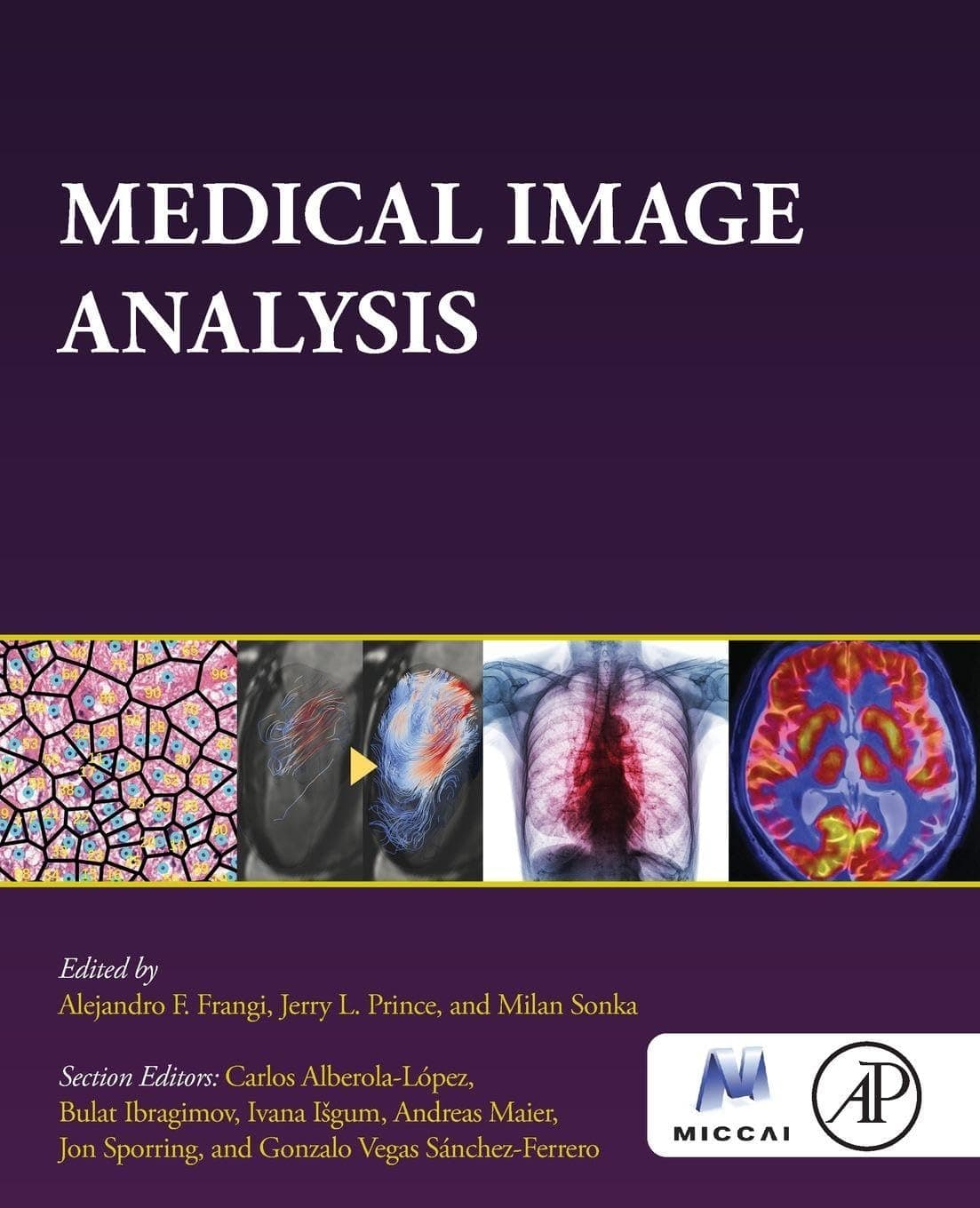 Medical Image Analysis