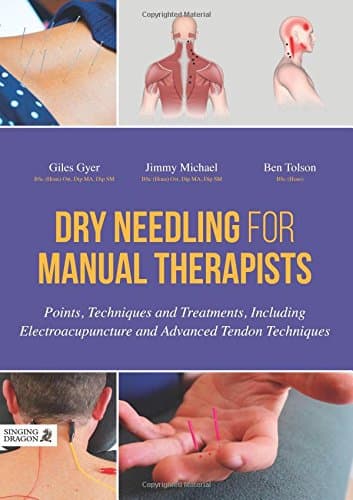 Dry Needling for Manual Therapists: Points, Techniques and Treatments, Including Electroacupuncture and Advanced Tendon Techniques