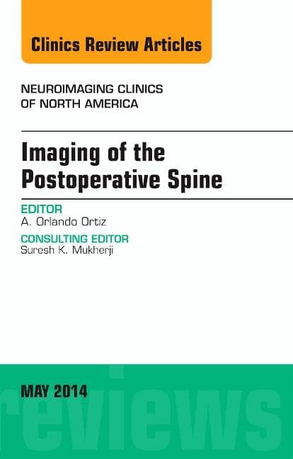 Imaging of the Postoperative Spine, an Issue of Neuroimaging Clinics: Volume 24-2