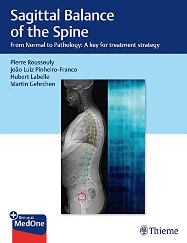 Sagittal Balance of the Spine (From Normal to Pathology: A Key for Treatment Strategy)