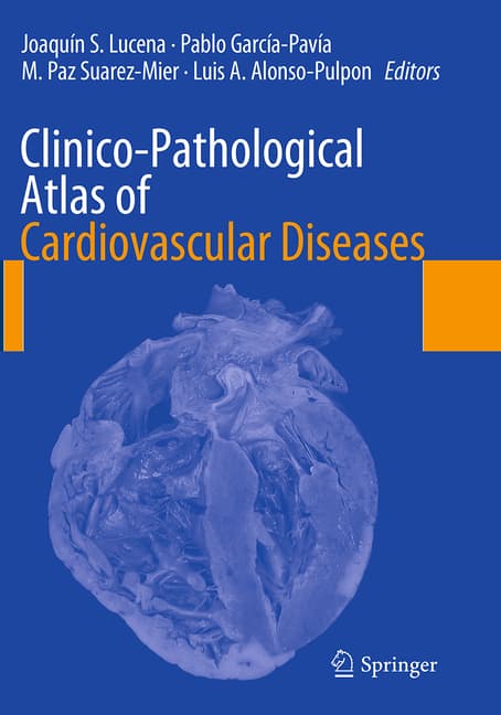 Clinico-Pathological Atlas of Cardiovascular Diseases (Softcover Reprint of the Original 1st 2015)
