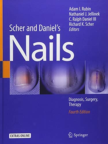 Scher and Daniel's Nails: Diagnosis, Surgery, Therapy
