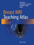 Breast MRI Teaching Atlas (2017)